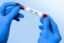 STD Test vs. HIV Test: