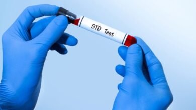 STD Test vs. HIV Test: