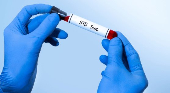 STD Test vs. HIV Test: